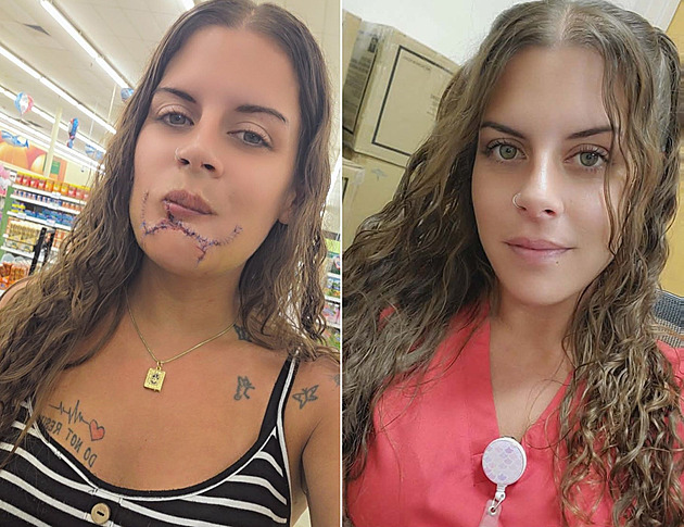 Pes napadl ženu v parku. Při útoku přišla o část brady a rtu