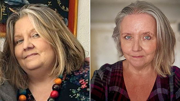 Léky na hubnutí mi zachránily život, říká kdysi obézní žena